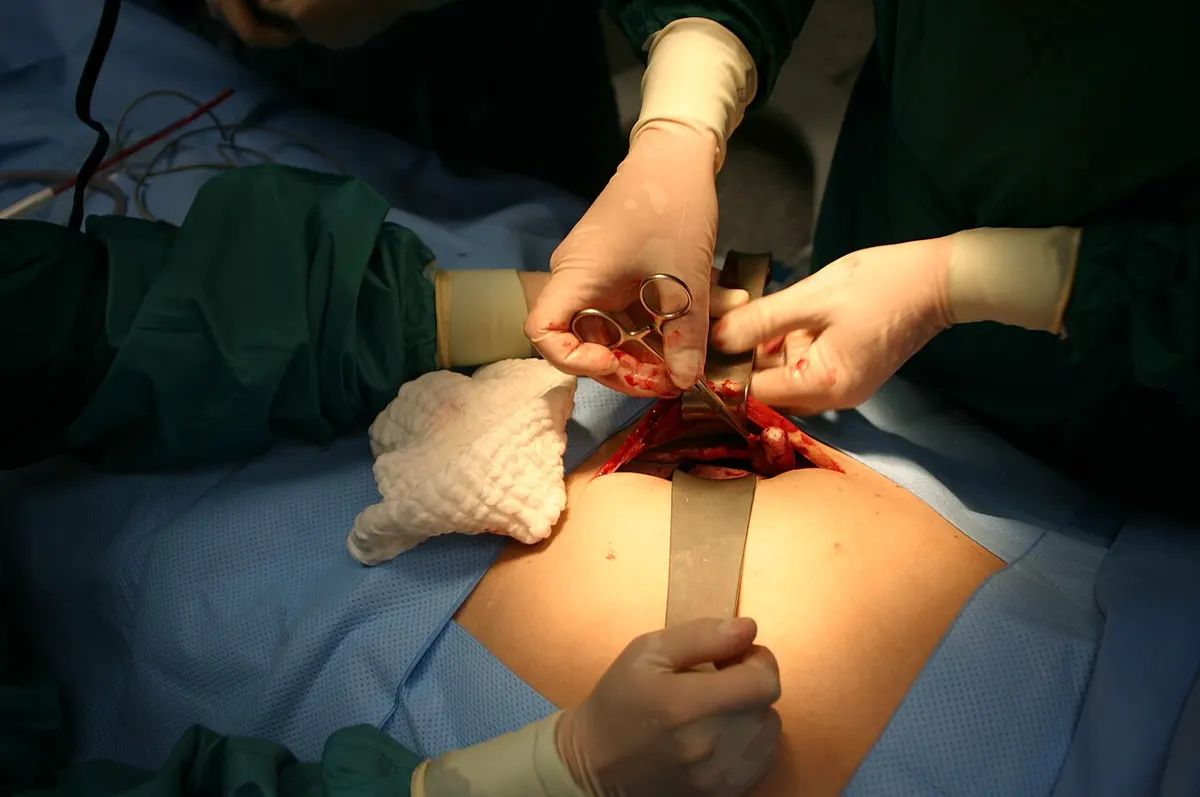 surgery